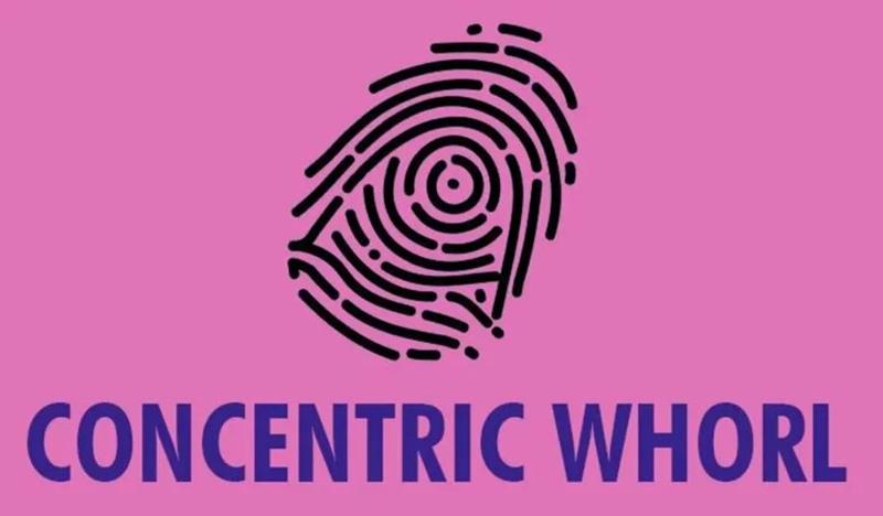 Chủng Concentric Whorl